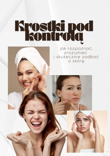 Krostki pod kontrolą!